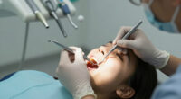 Can Confirm, I've Had All M Dental Work Done In Mexico